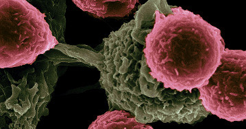 Áttörés a rák gyógyításában: teljes daganatok tűntek el a kísérletekben