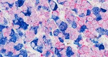 Magyar kutatók áttörése: egy új vegyület teljes gyógyulást hozott mellrák-modellben